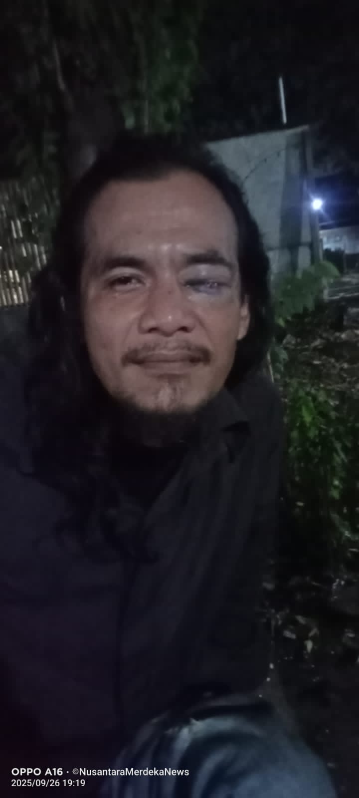 Jurnalis Ambarita Dikeroyok Saat Liputan Dugaan Makanan Kadaluarsa di Bekasi